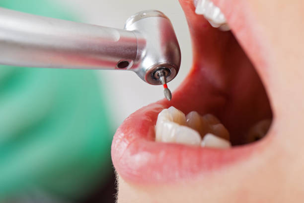 Best Root Canal Emergency Dentist  in Krum, TX